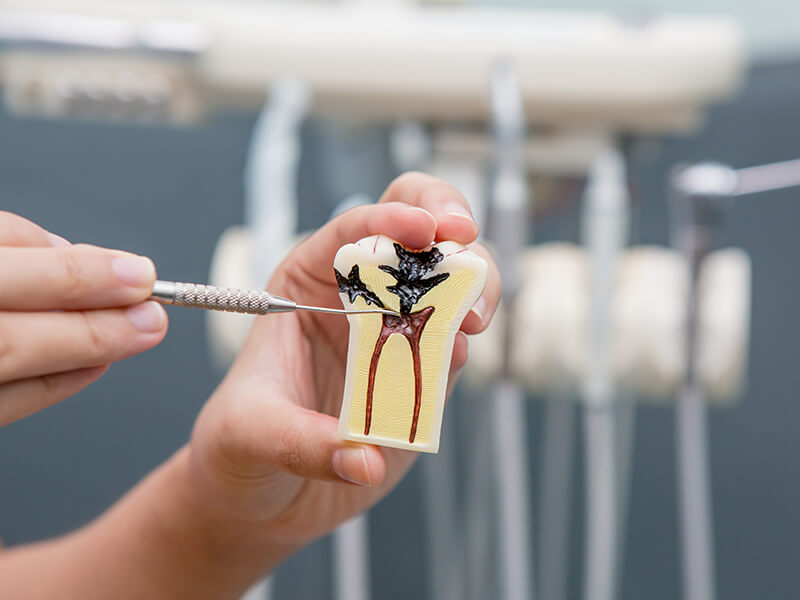 pessoa apontando para a parte interna do dente em uma escultura